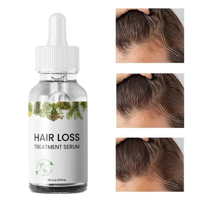 Hair Growth & Hair Loss Treatment Serum 30ml (Pack of 2)
